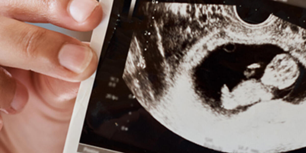 Bébé né avec une malformation passée inaperçue : les échographies  sont-elles fiables ?